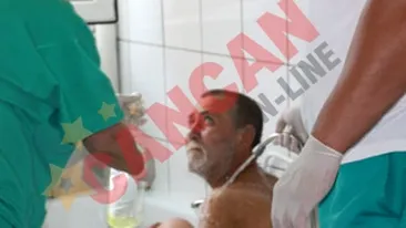 Mancat de viu de viermi