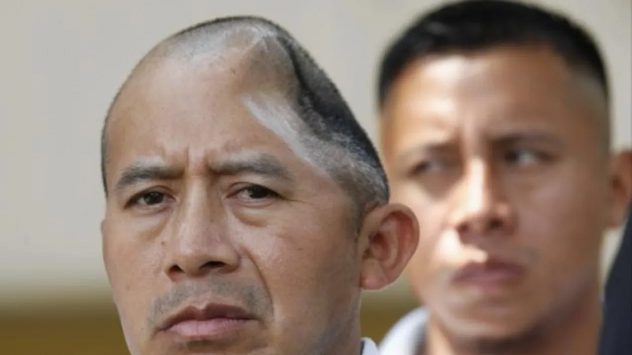 A rămas cu o gaură in cap după o bătaie cruntă! Craniul lui e ca o plăcintă. Cum arată bărbatul care nu iese din casa fara sapca