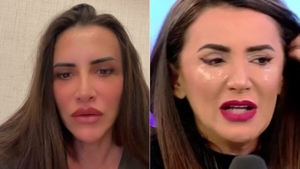 Ce a pățit Mara Bănică la mână. Imaginea cu palma roșie i-a îngrijorat pe fani