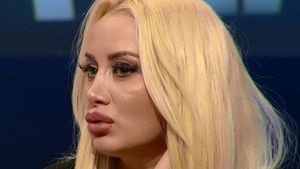 Simona Traşcă vrea să-şi opereze toată faţa: „Cu intervenţia asta lumea o să-mi dea 18-19 ani!”
