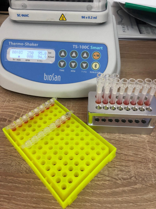 Testele efectuate în cazul managerului de la Spitalul din Bacău au ieșit negative, deși o analiză ulterioară a anticorpilor a arătat că a avut COVID-19