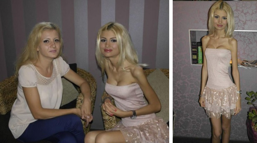 În 2013, anorexica Flavia Apostol avea doar 38 kg la 1.72 m! Cum arată acum și câte kilograme are