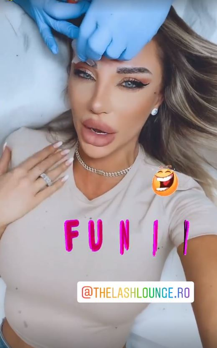 Bianca Drăgușanu, problemă delicată după o intervenție estetică: “Ce mi-o fi trebuit mie implant de sprâncene? O porcărie”