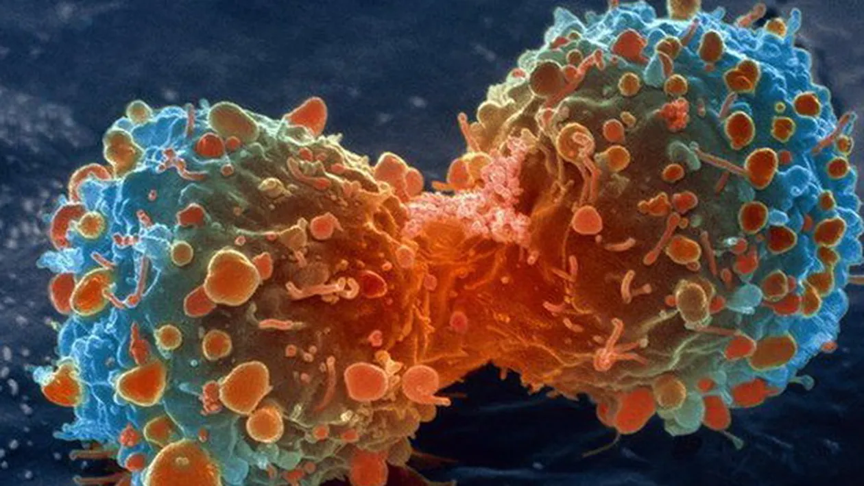 Atentie, romani! Ce se poate intampla daca bei apa de la robinet! Specialistii avertizeaza: CANCER!