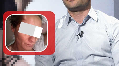 Cel mai cunoscut manechin al României a recidivat. Fosta iubită și-a făcut curaj să vorbească: “Abuzurile erau din cauza furiei lui”