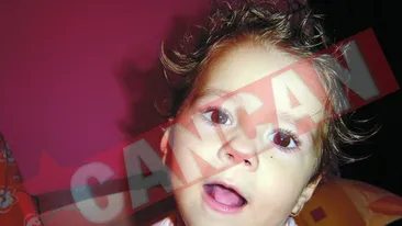 S-a nascut adormita, iar acum este paralizata