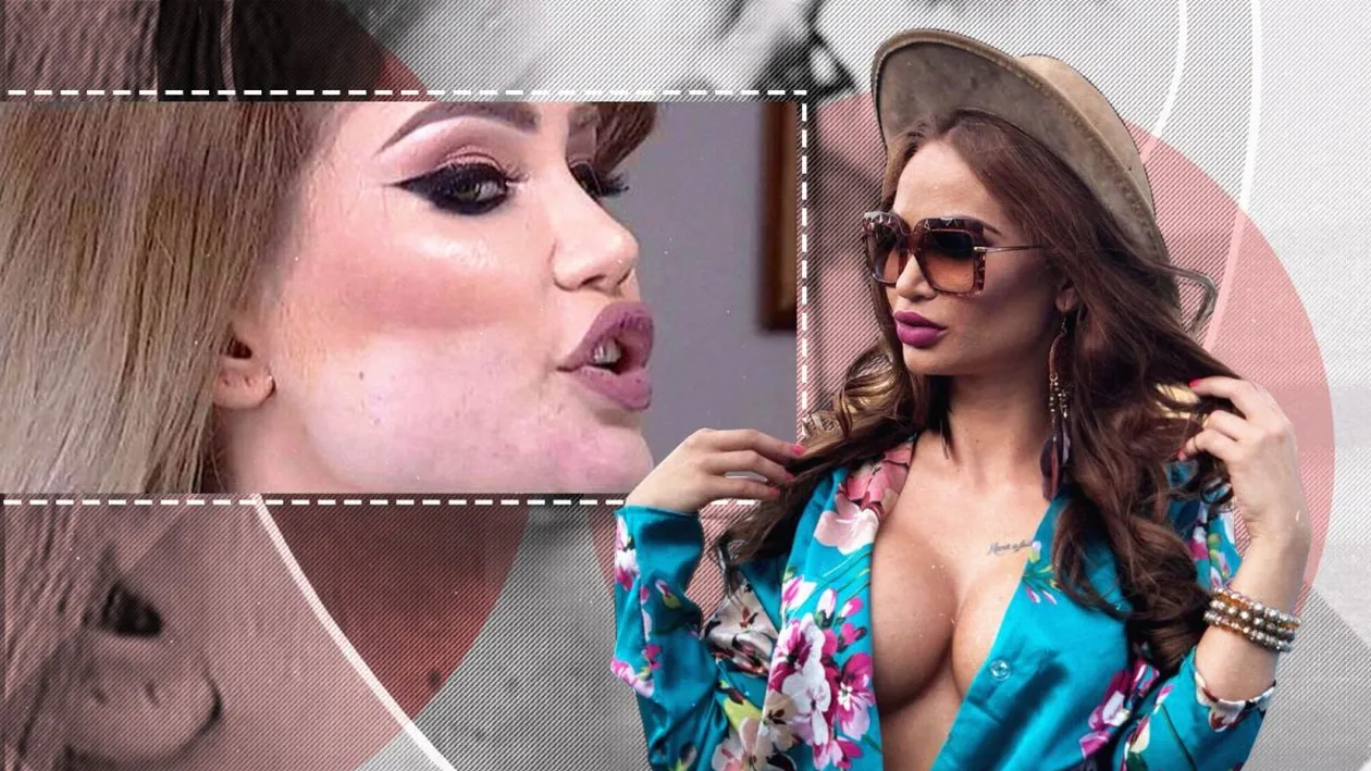 Maria Ilioiu, mutilată la opt luni de la intervenția estetică. Fosta ispită de la „Insula Iubirii” s-a demachiat în direct “Sunt foarte revoltată”