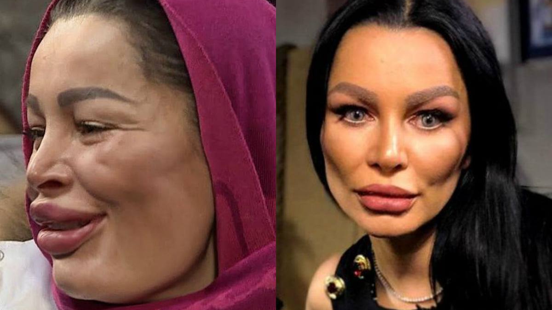 Cum arăta Brigitte înainte de operaţiile estetice? Cu ultima intervenţie l-a şocat şi pe Florin Pastramă. Galerie FOTO