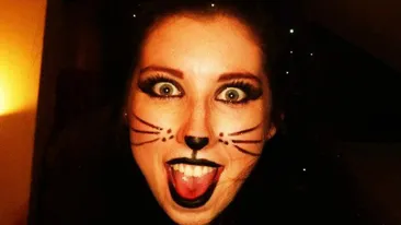 A avut arsuri de 96% pe tot corpul si a suferit peste 200 de operatii! Cum arata acum