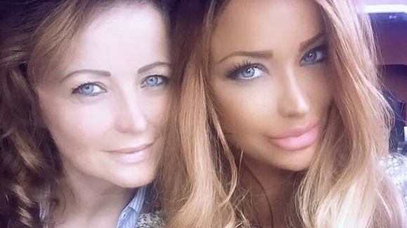BIANCA DRĂGUŞANU a spus totul despre operaţia mamei sale, din urmă c-o săptămână: „Se vede o gaură în nas!“