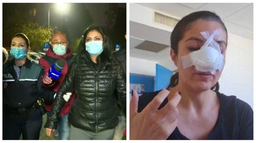 Primele declarații ale femeii care a desfigurat-o pe Cristina Joia: ”Mi-a rupt ștergătorul de la mașină și m-a înjurat”