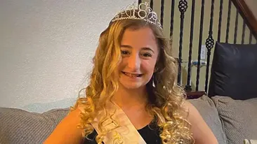 Tânăra din imagine s-a născut cu dinți transparenți. Ce înseamnă și ce s-a întâmplat când avea 19 ani