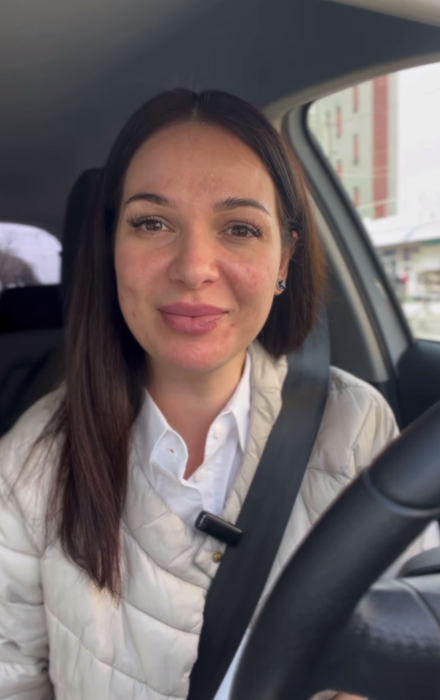Deea Maxer are probleme cu acneea/ Sursa foto: Instagram
