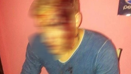 Imagini SOCANTE! Un fotbalist englez a fost lovit cu TOPORUL in cap. Afla cine este de vina
