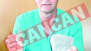 Colectioneaza pietre din rinichi