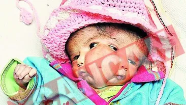 Fetita cu doua chipuri