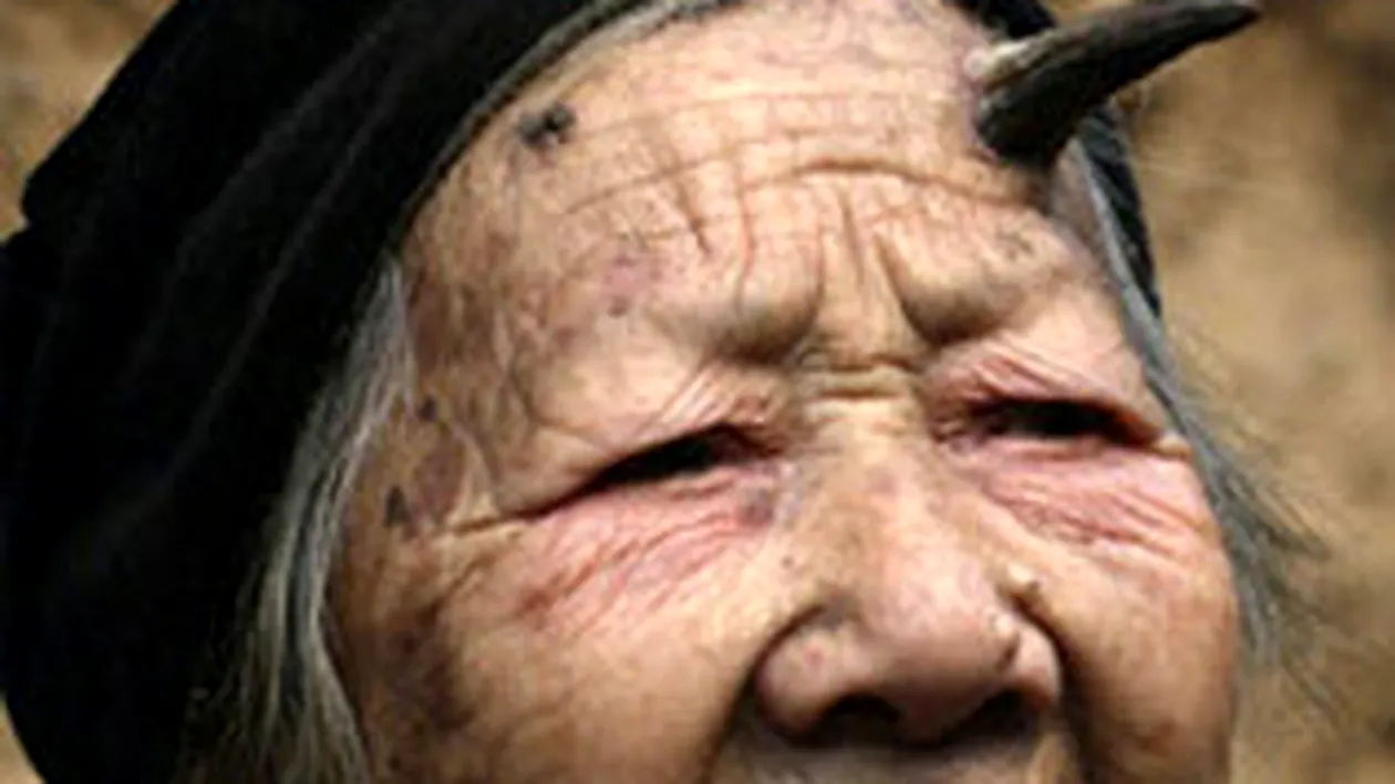 Femeia-diavol traieste in China! I-a crescut un corn in frunte