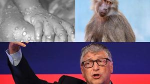 Bill Gates a prezis că va veni valul de îmbolnăviri cu variola maimuței: ”Suntem gata pentru următoarea pandemie”