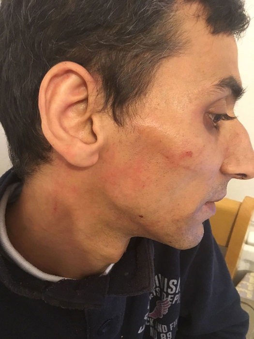 Românul susţine că a fost lovit inclusiv la faţă