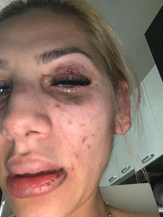 Yoannes, noi acuzații la adresa lui Tzancă Uraganu! „A bătut-o pe fata asta până a avortat”