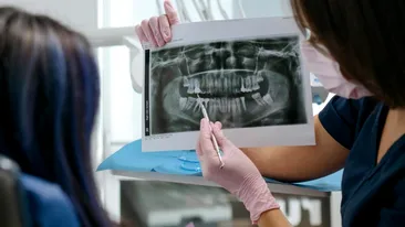 (P) Ce trebuie să știi despre radiologia dentară: tipuri, tarife și utilitatea ei în stomatologie