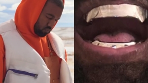 Kanye West și-a înlocuit toți dinții cu proteze de titan, în valoare de 850 de mii de dolari! Rapper-ul a avut ca model un film cu James Bond