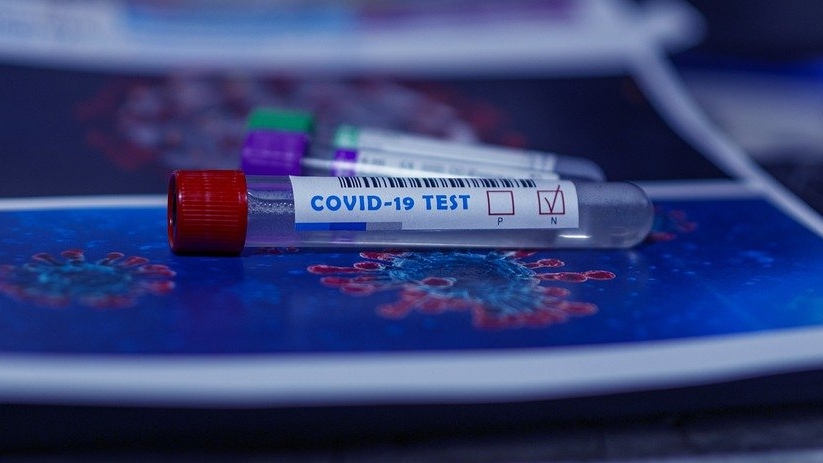 Teste diagnostic și anticorpi COVID-19. Cum afli dacă ești infectat sau dacă ai avut infecția în trecut 