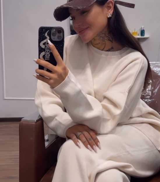 Diandra și-a topit acidul din buze/ Sursa foto: Instagram