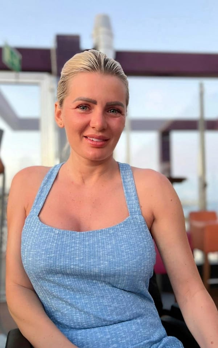 Drama cântăreței de muzică populară Anamaria German. Un accident teribil a lăsat-o paralizată