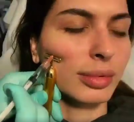 Mădălina Pamfile şi-a augmentat buzele şi şi-a modificat volumetria facială