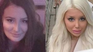 A cheltuit o avere pentru a arăta ca păpușa Barbie. Mărturiile unei tinere dependentă de operațiile estetice