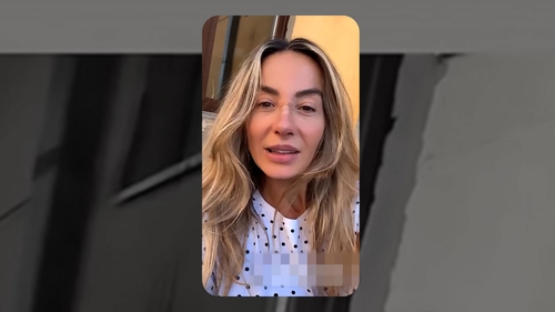 Cum arată Flavia Mihășan la 3 săptămâni de la operația la nas. Vedeta e schimbată total!