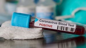 Coronavirus România. Numărul deceselor din cauza COVID-19 a ajuns la 469