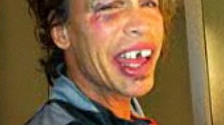 Steven Tyler, solistul trupei Aerosmith, a cazut in baie si si-a rupt doi dinti! Uite-l cum arata desfigurat!