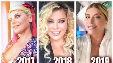 Loredana Groza a vorbit despre operațiile estetice pe care le are