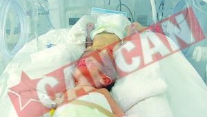 Viata siamezilor de la Brasov atarna de un fir de par
