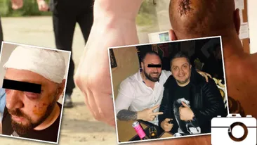 Ce a apărut pe pagina temutului interlop, la un an de când a fost snopit în bătaie: ”Am văzut moartea cu ochii...”