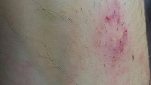 Un poliţist doljean aflat în misiune a fost muşcat de un fost deţinut