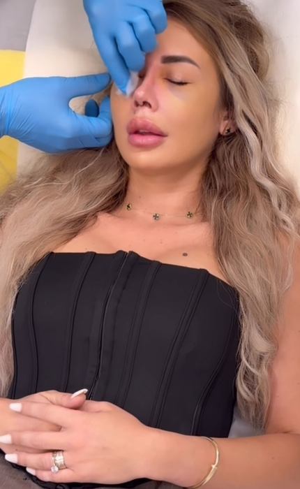 Maria Avram, de nerecunoscut după rinoplastie! Cum arată acum concurenta Insula iubirii 2025