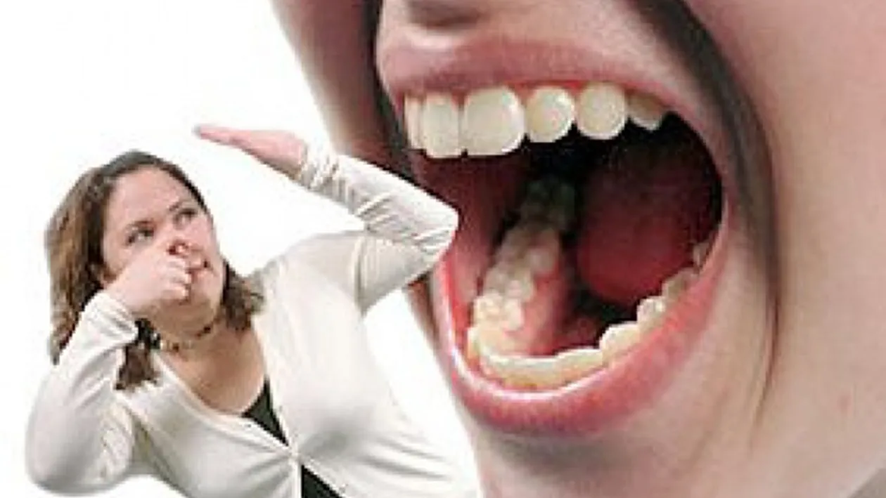 Probleme cu respiratia urat mirositoare? Vezi care sunt cauzele si cum poti preveni aceasta situatie