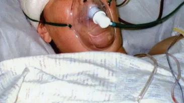 Un zid s-a prabusit peste un vasluian de 42 de ani! In stare critica la spital!