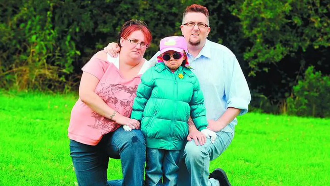 E alergica la lumina zilei