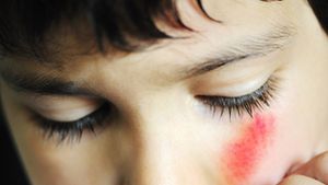 VIDEO Un copil de 5 ani a fost lovit cu toporul in cap, de fratele sau mai mare!