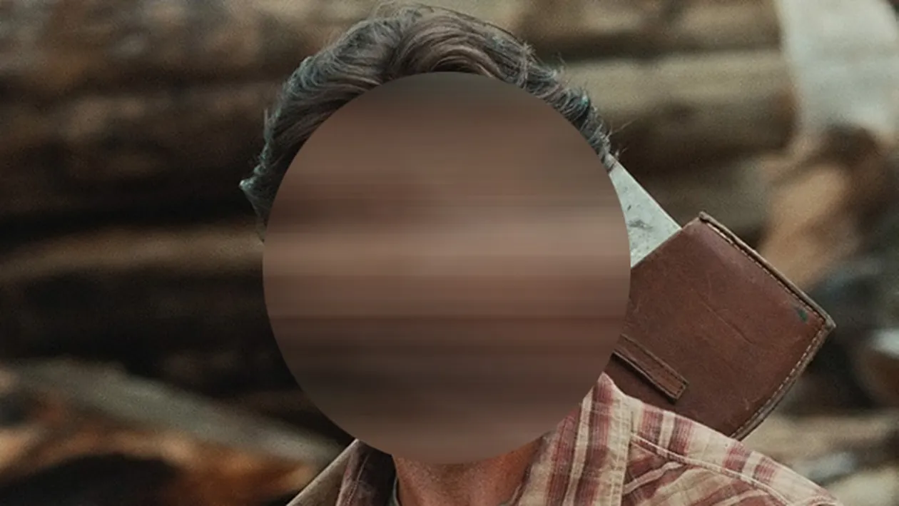 Un cunoscut actor, tratat de cancer de piele! S-a operat recent: Vă rog să nu fiţi nesăbuiţi, ca mine