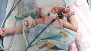 A murit David Andrei, bebelușul din Sebeș care s-a născut cu o malformație gravă