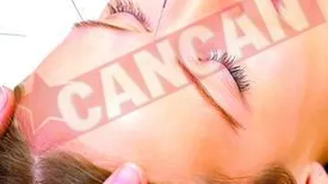 Cand va doare capul faceti acupunctura!