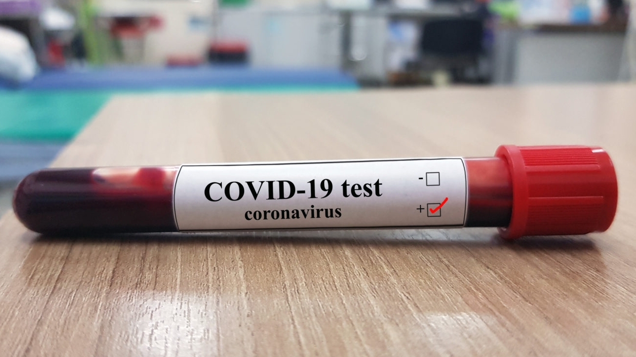 Şcolile din Capitală vor fi folosite pe post de centre de testare pentru coronavirus. Părinţii sunt revoltați