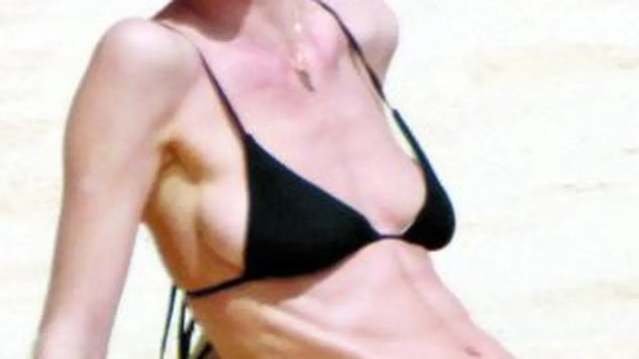 Sufera de anorexie?