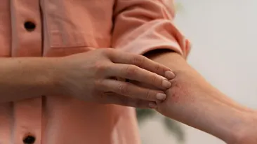 (P) Tratament pentru psoriazis ușor de urmat și integrat în rutina zilnică. Remisie îndelungată și efecte vizibile rapid