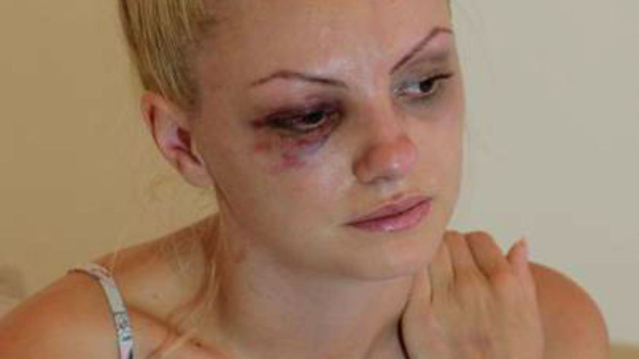 Alexandra Stan după bătaia încasată de la Marcel Prodan